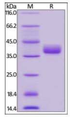 Human CD52, Fc Tag on SDS-PAGE under reducing (R) condition. The gel was stained overnight with Coomassie Blue. The purity of the protein is greater than 95%.